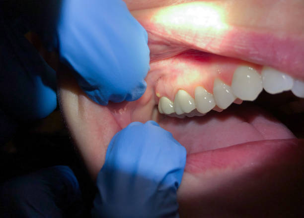 Best Emergency Orthodontic Repairs in East Speer, NC
