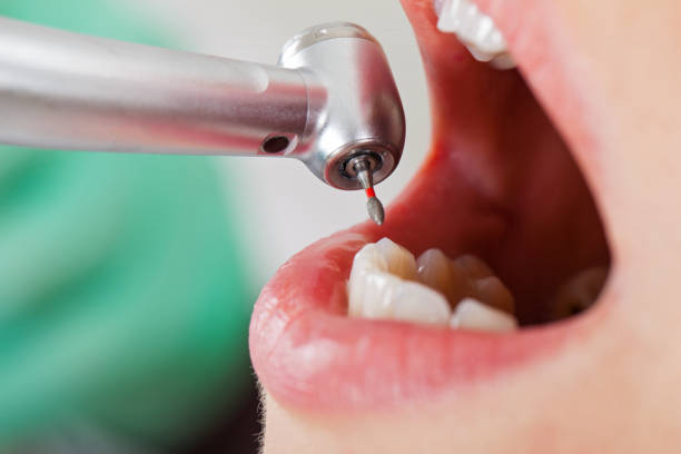 Best Emergency Dental Care for Trauma or Injury in East Speer, NC